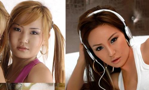 anu plastic surgery 3