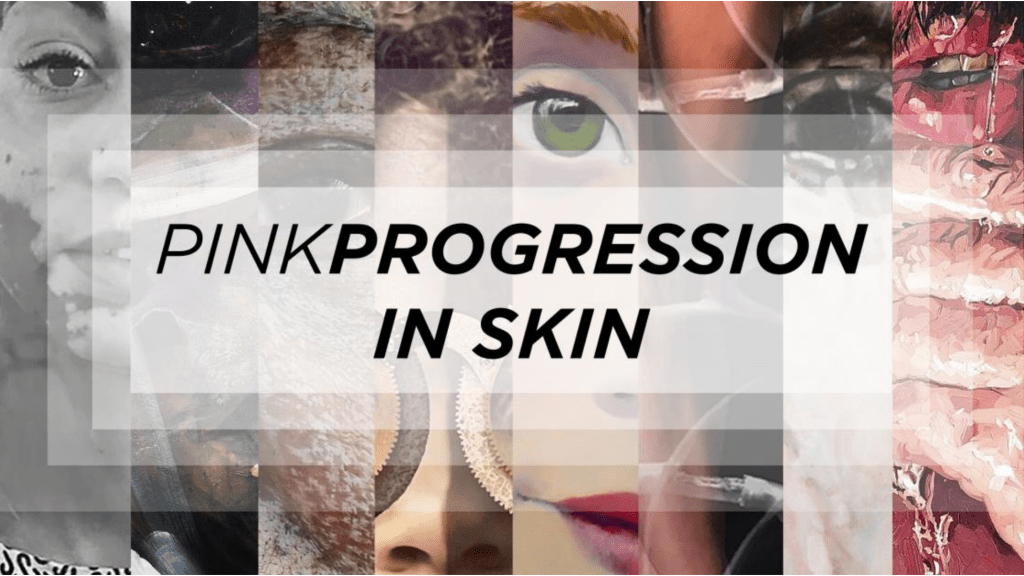 “In Skin”Group Exhibition @ Philip J Steele&nbsp;Gallery